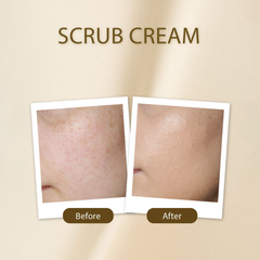 Scrub Cream