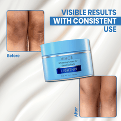 Whitening Cream For Sensitive Parts
